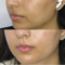 Smoother, Clearer-Looking Skin