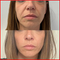 Cellular Renewal & Collagen Support