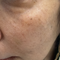 Improved tone and texture