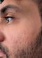 Pore Refinement